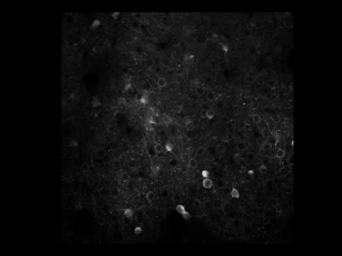 Neural Activity in the PPC