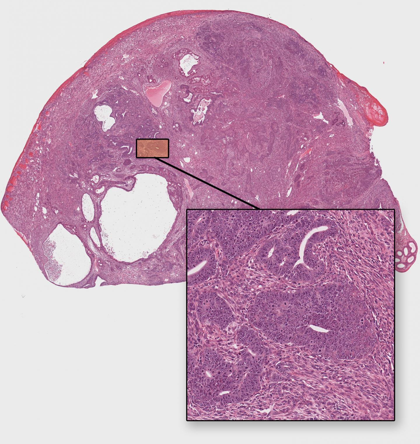Germ Cell Tumor