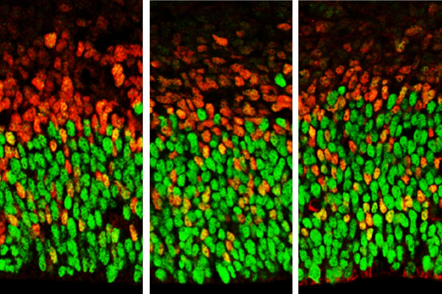 Brain Cells with Lower Levels of Foxp Function