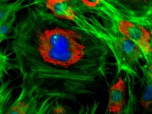 Pre-adipocyte Intriguing Scaffold