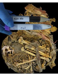 Microbiome characterization of a pre-Hispanic man from Zimapán, Mexico: Insights into ancient gut microbial communities