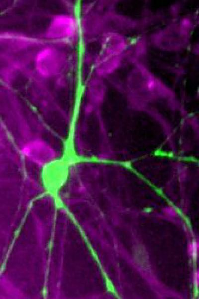 Parkinson's Killer Lurks Within