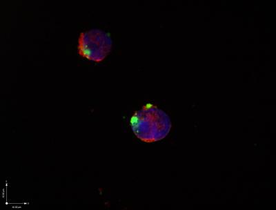 Leukemic Cells