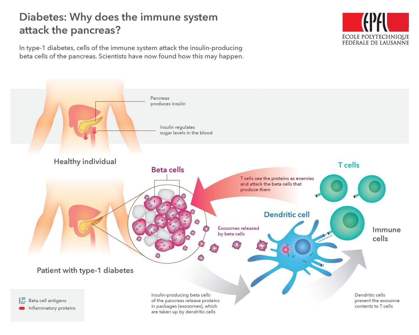Protein Packaging May Cause The Immune Attacks Of Type 1 Diabetes 