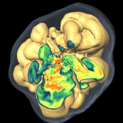 3-dimensional Explosion Simulation