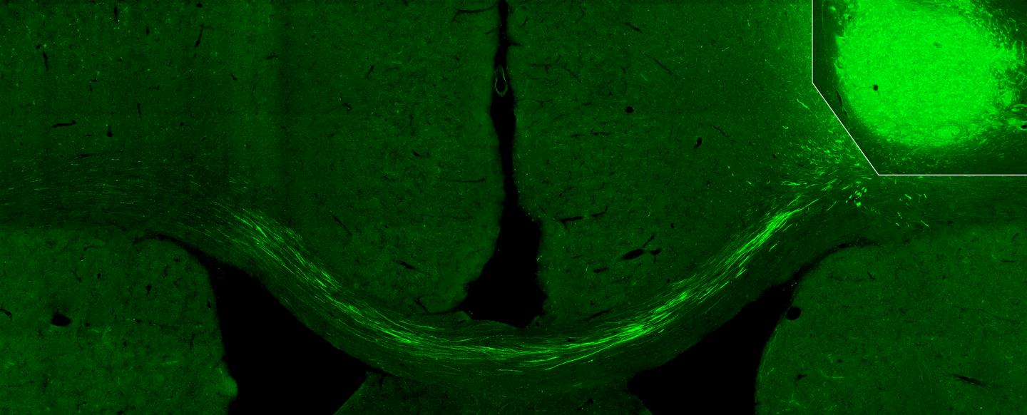 Fibers