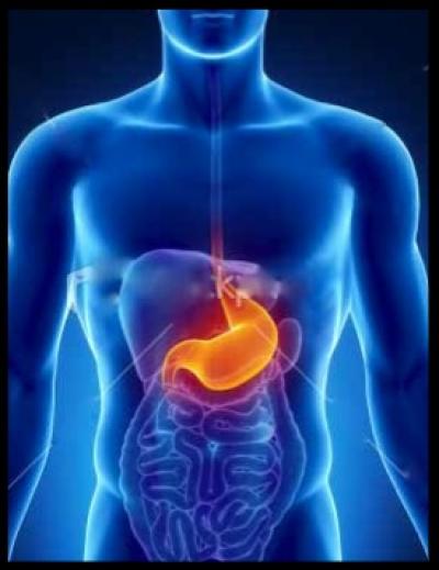 Gastric Cancer