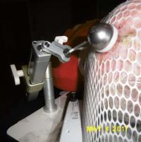 Brachytherapy Proves Effective in Treating Skin Cancer