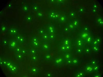 Cysts and Oocysts
