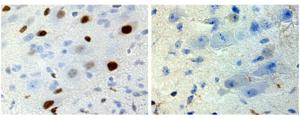 Microscopy images of spinal cord tissue from male (left) and female (right) SBMA model mice on the first day after birth