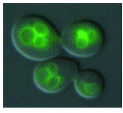 Link Between Parkinson's Disease Genes and Manganese Poisoning (1 of 2)