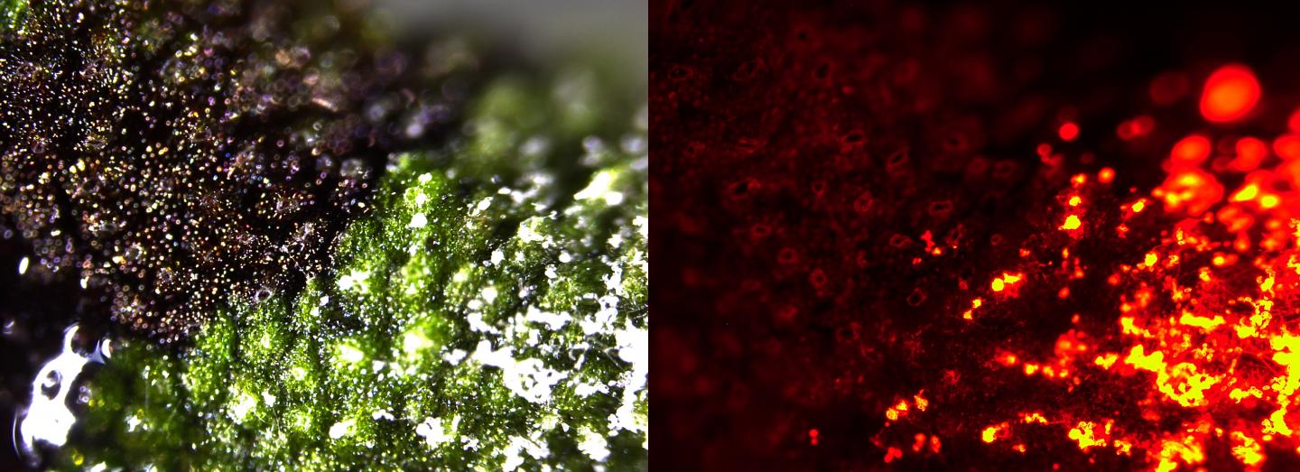 Microscopic Image of a Liverwort