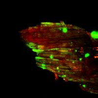 False color representation of a SHG microscopy