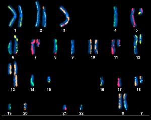 Pancreatic Cancer Cell Chromosomes