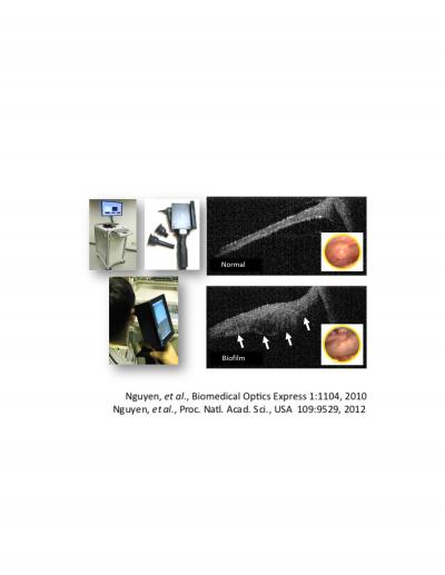 OCT Scanner and Biofilm