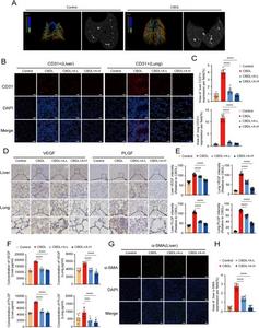 The use of agrimoniin can alleviate hepatic and pulmonary angiogenesis and the fibrosis of liver tissue