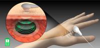 Powering Devices Goes Skin Deep