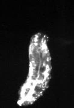 <em>Drosophila</em> Larva with Some Neurons Disrupted