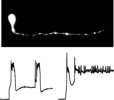 Micrograph Recordings