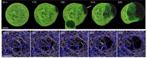 Agent-based computational model for dissecting the molecular mechanism of bleb formation