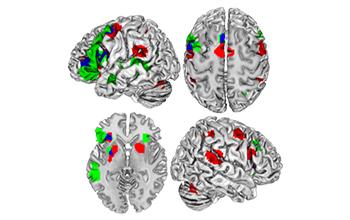 fMRI Image of the Human Brain