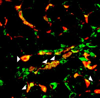 Injured Heart Cells Take on Helpful Blood Vessel Cell Characteristics