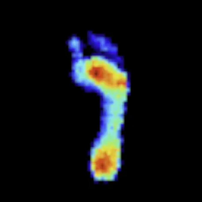 Smart insole pressure data