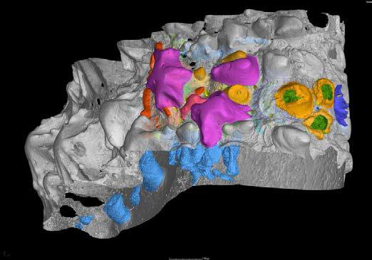 <i>Lophosteus</i> Jaws (3 of 3)