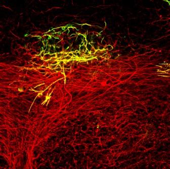 Blockade to Repair of White Matter Injury