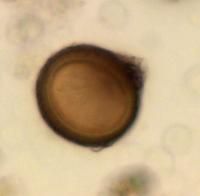 <i>Taenia</i> Tapeworm Egg