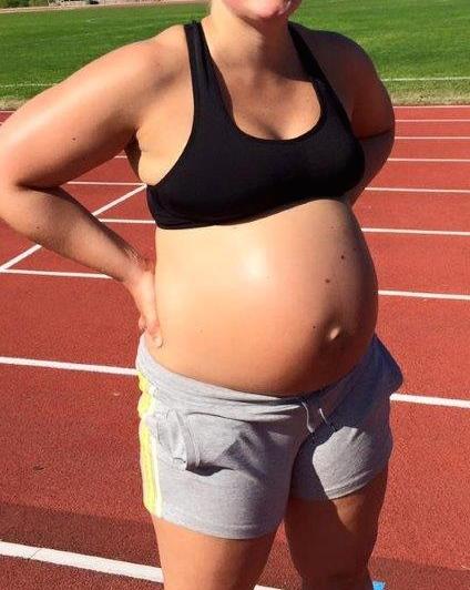 Gestational Diabetes Can Be Prevented in High-Risk Women