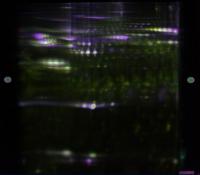 Searching for Proteins Involved in Laminitis