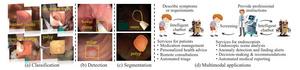 How AI Is Reshaping Colonoscopy