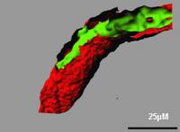 Human Vascular System in Mice (2 of 2)