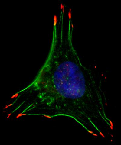 Breast Cancer Cell in Low Oxygen