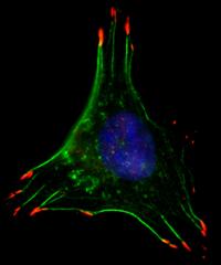 Breast Cancer Cell in Low Oxygen