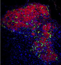 Engrafted Islet in Hydrogel