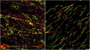 ATR inhibition disrupts replication fork progression