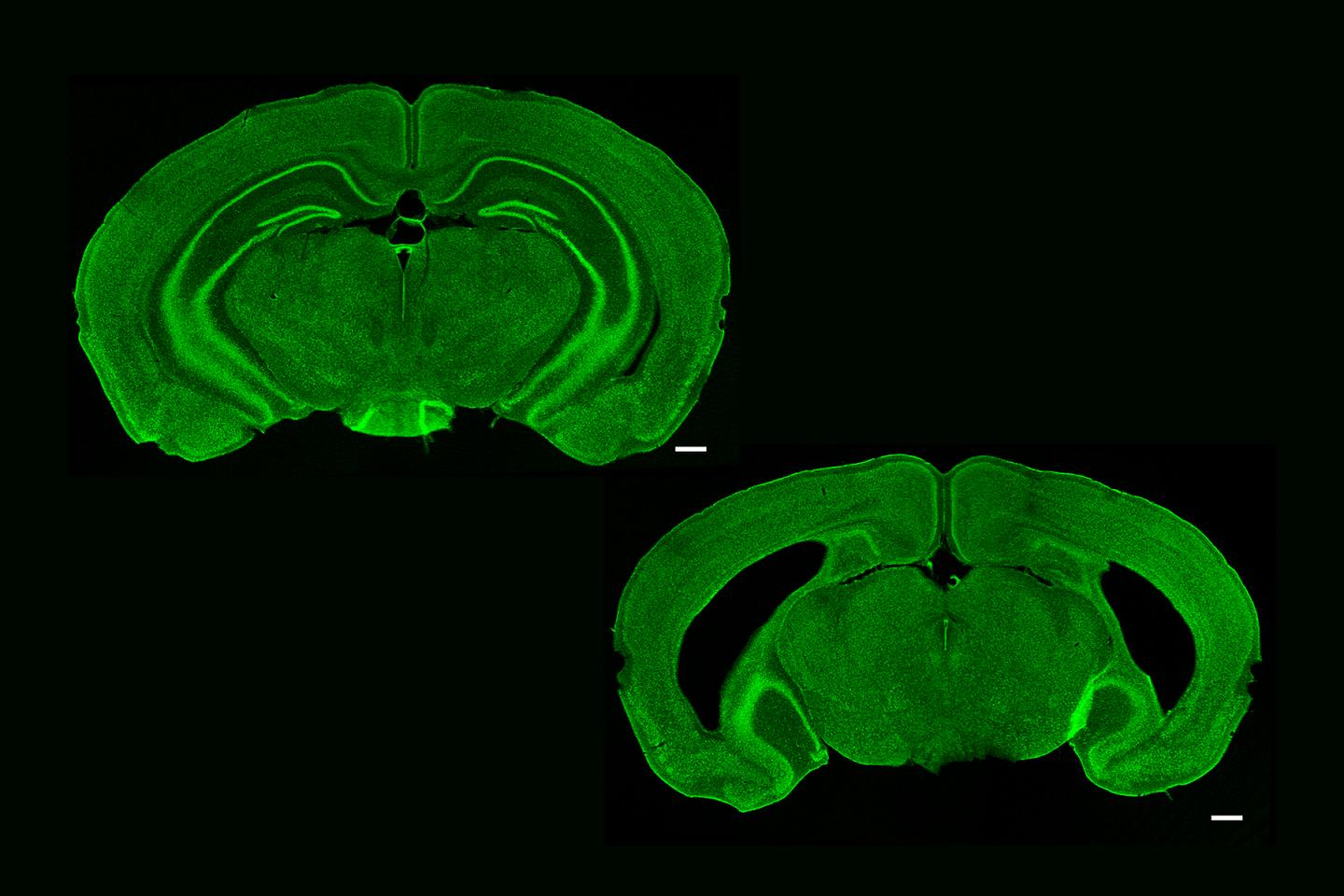 To Have Hippocampus and Have Not