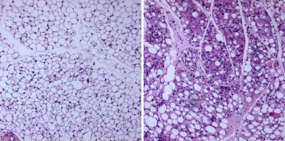 White Fat Cells