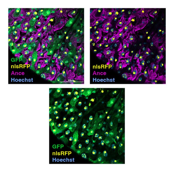 Low amino acid food induces cell death by erebosis