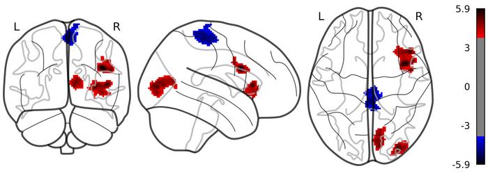 New Study Identifies Novel Neural Pathway to Treat Alcohol Use Disorder