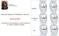 Ideal AD Biomarker