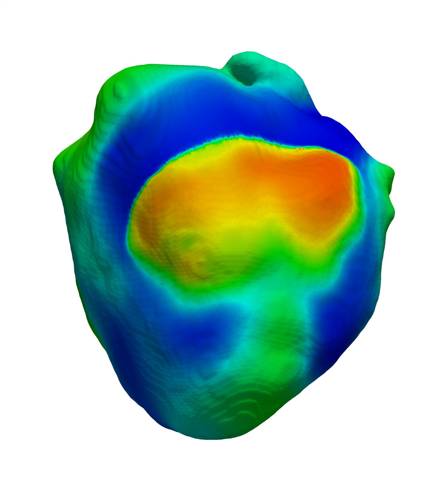 Scientists Use 'Virtual Heart' to Model Heart Failure