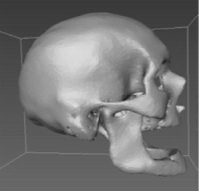 Reconstructing a Skull