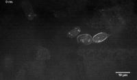 Blood Cells in a Live Zebrafish Embryo