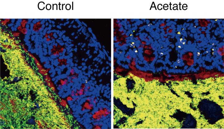 Acetate-triggered immune response