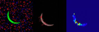 Malaria Parasite
