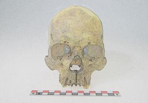 Skeleton that yielded a M. lepromatosis genome