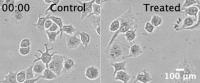 Live Imaging of Cancer Cells